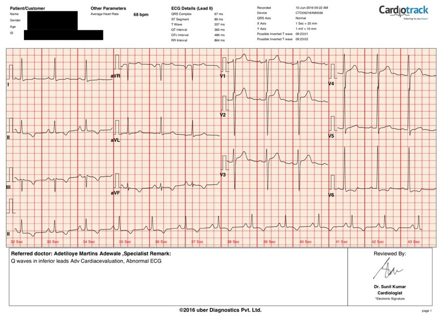 A real Cardiotrack report, AI interpreted and physician signed